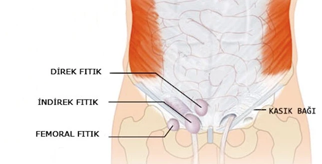 HER İKİ ERKEKTEN BİRİNDE KASIK FITIĞI VAR